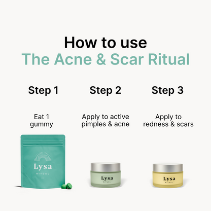 The Acne & Scar Ritual