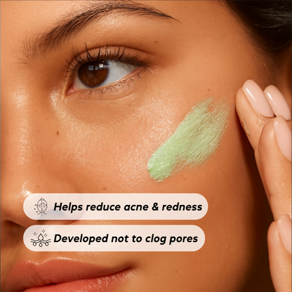 Acne Reset Ritual